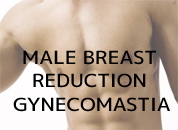 整容手术在乌特迪尔-2022年卡塔尔世界杯直播male breast reduction Gynecomastia