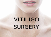 整容手术在乌特迪尔-2022年卡塔尔世界杯直播vitiligo surgery
