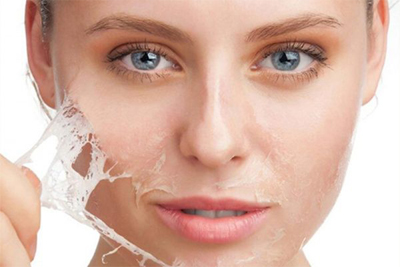 Cosmetic Surgery in udaipur - chemical peeling