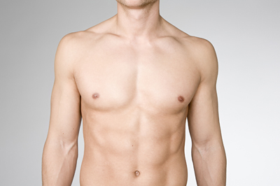 Cosmetic Surgery in udaipur - gynecomastia